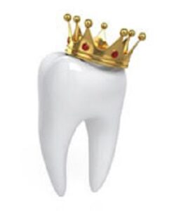 Read more about the article My Dentist Said I Need a Crown…